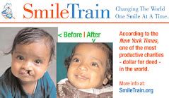 the smile train scam.